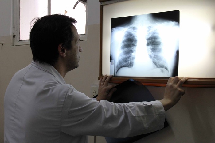 Semana de la Tuberculosis: una enfermedad prevenible y curable